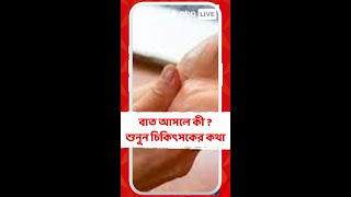 বাত আসলে কী জানেন ? শুনুন চিকিৎসকের কথা