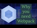 Webpack | Why you need Webpack