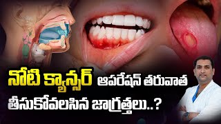 నోటి CANCER SURGERY తర్వాత ఎటువంటి జాగ్రత్తలు తీసుకోవాలి? | Dr.Avinash Chaitanya | Kaizen Hematology