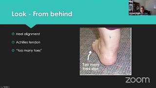 Ankle arthritis for the Fellowship exam