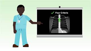Nasogastric tube misplacement: continuing risk of death and severe harm