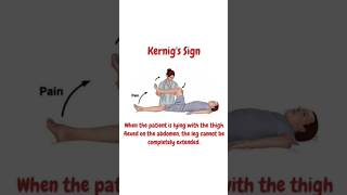 Signs of Meningitis | #kernig #brudzinski #meningitis #ytshorts#shorts #medical #imagebasedquestion