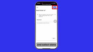 How to add consent form