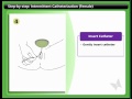 Bladder Step-by-Step IC (Female)