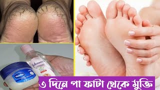 মাত্র ৩ দিনে পা ফাটা দুর করার উপায়/ Pa fata dur korar upay/Remedies/tipswithshirin..