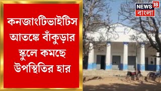 Conjunctivitis : বাঁকুড়ায় চোখ রাঙাচ্ছে কনজাংটিভাইটিস, আতঙ্কে কমছে স্কুলে উপস্থিতির হার| Bangla News