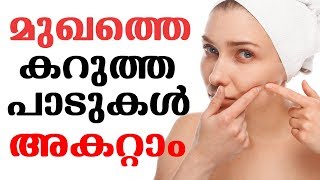 മുഖത്തെ കറുത്ത പാടുകള്‍ മാറ്റി നിറം വര്‍ദ്ധിപ്പിക്കാൻ | How To Remove DARK SPOTS In 7 Days