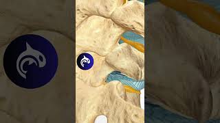 Lumbar Microdiscectomy of the Spine - See How It Works - 3D Animation #4k #backpain #chronicpain