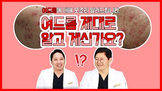 [피부재생마술사]😡여드름과 여드름자국,제대로 알고계신가요?😡