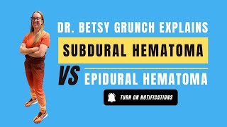 Epidural vs. subdural hematoma #neurosurgery #emergency #subduralhematoma #epiduralhematoma