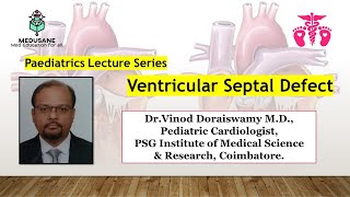 Ventricular Septal Defect - Case Discussion | Pediatrics | Dr.Vinod Doraiswamy M.D., | Medusane