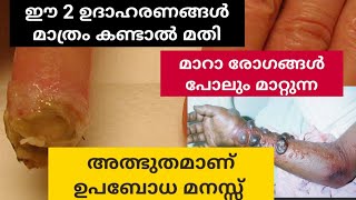 ഉപബോധ മനസ്സ് കൊണ്ട് രോഗങ്ങൾ മാറ്റാം Heal Your Diseases Using Subconscious Mind Manasinte Rahasyangal