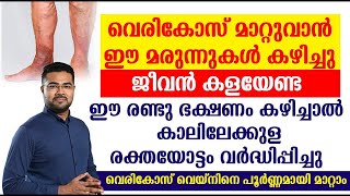 ഈ രണ്ടു ഭക്ഷണം കഴിച്ചാൽ കാലിലേക്കുള രക്തയോട്ടം വർദ്ധിപ്പിച്ചു വെരികോസ് വെയ്‌നിനെ പൂർണ്ണമായി മാറ്റാം