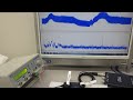 超音波プローブの超音波伝搬実験（表面弾性波の相互作用）