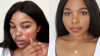 HOW TO COVER HYPERPIGMENTATION AND DARK SPOTS ON BROWN SKIN