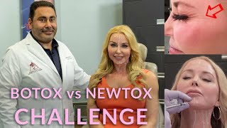 Botox vs. Newtox: Which is Better?|50+ Skincare