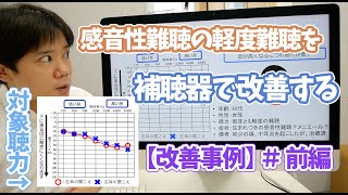 【改善事例】感音性難聴の軽度難聴を補聴器で改善した事例・前編　聞こえの状況と聞こえの改善案