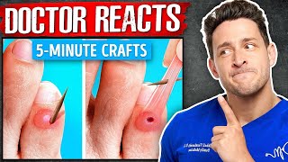 The WORST 5-Minute Crafts “Health Hacks”