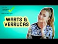 Top Hacks for Wart and Verruca Removal – Doctor’s Tips