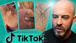 Dermatologist reacts to Crazy TikTok Videos!