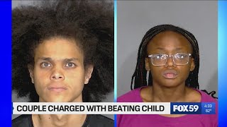 3-year-old hospitalized with severe brain injuries; guardians charged with neglect