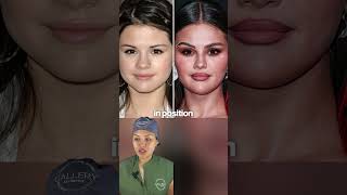 Selena Gomez Before After Plastic Surgery