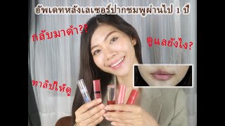 รีวิวสีปากล่าสุด หลังจากทำเลเซอร์ปากชมพูมา 1ปีครึ่ง วิธีดูแล ทาลิปให้ดู |SichatStory