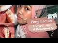 TAMBAL GIGI GRATIS ???? PENGALAMAN TAMBAL GIGI DI PUSKESMAS | PAKAI BPJS | Rekomen atau tidak ???