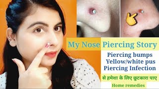 My nose piercing story ll Piercing Bumps, Yellow, White pus गायब करने का आसान व घरेलू उपाय ll