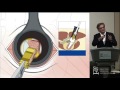 MIS & Navigation: Pros & Cons  - Roger Hartl, MD