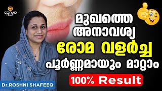 മുഖത്തെ അനാവശ്യ രോമ വളർച്ച പൂർണ്ണമായും മാറ്റം | Roma Valarcha Thadayam Malayalam | Dr Roshni Shafeeq