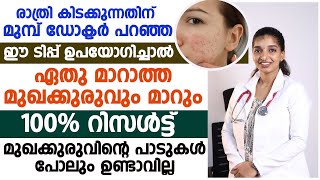 രാത്രി കിടക്കുന്നതിന് മുമ്പ് ഈ ടിപ്പ് ഉപയോഗിച്ചാൽ ഏത് മാറാത്ത മുഖക്കുരുവും മാറും|Facepimple reduce