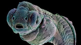 Amazing Electron Microscope Images