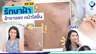 รักษาฝ้า | EP.32 | ฝ้าจาง หน้าใส! นักเรียนนอกอังกฤษ แชร์ประสบการณ์รักษาฝ้ากับ | BSL Clinic