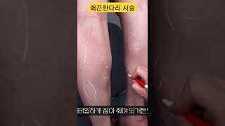 걸그룹 종아리주사 #톡스앤필삼성 #톡스앤필 #김태영원장