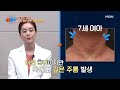 나이에 어울리지 않는 주름 무너진 피부 장벽이 원인 mbn 230705 방송