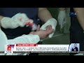 boga no. 1 sanhi ng firecracker related injury online tutorial sa paggawa nito ... 24 oras