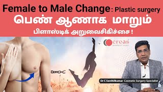 பெண் ஆணாக  மாற அறுவைசிகிச்சை ! |Female to Male Transgender Surgery.