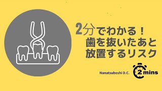 2分でわかる！歯を抜いたあと放置するリスク