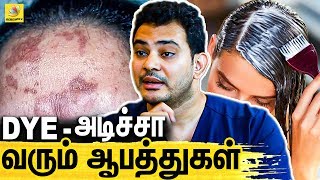 DYE அடிப்பதால் SKIN Problems வருமா ? Dr.Sethuraman Interview About Hair DYE | Hair Coloring