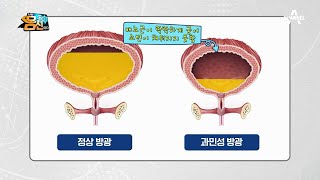 '과민성 방광'은 방광이 *5분의 1*로 작아진 상태다?!ㅠㅠ | 나는 몸신이다 263 회