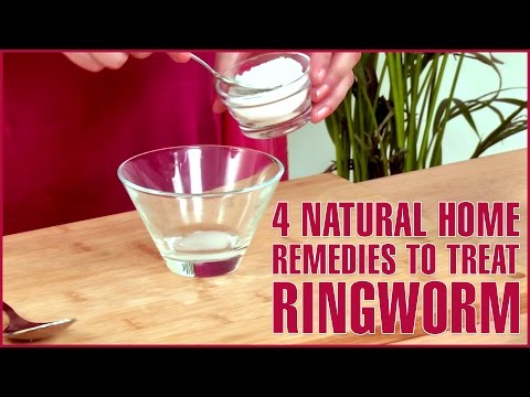 4 Best Natural Home Remedies For RINGWORM TREATMENTS 4 Best Natural Home Remedies For RINGWORM TREATMENTS