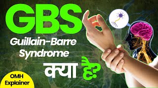 GBS - Guillain-Barre Syndrome क्या है? | OMH Explainers | OnlyMyHealth