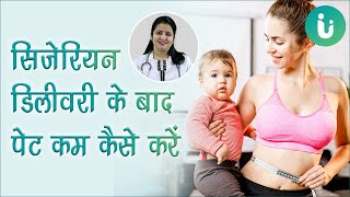 सिजेरियन डिलीवरी के बाद इस तरीके से करें पेट कम, Cesarean delivery ke baad pet kam karne ke upay