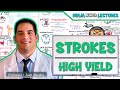 Ischemic and Hemorrhagic Strokes | High Yield