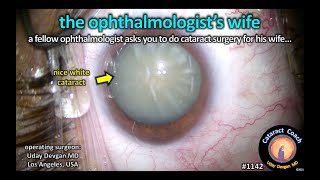 CataractCoach 1142: white cataract in the ophthalmologist's wife