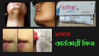 Vaniflo Cream  Bangla Review | মহিলাদের মুখের অবাঞ্ছিত লোম এবং দাড়ির চুল দূর করার কার্যকারী ক্রিম |