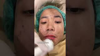 Review facial di Ella klinik 🫶