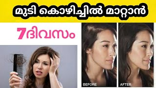 7ദിവസം കൊണ്ട് മുടി കൊഴിച്ചിൽ പിടിച്ചു കെട്ടിയ പോലെ നിക്കും |Stop Hairfall Home Remedies 100%Natural