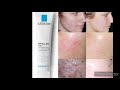 قبل ماتشري effaclar duo دخلي شوفي فيديو واش فعلا كتحرق البشرة؟؟ 🤔🤨